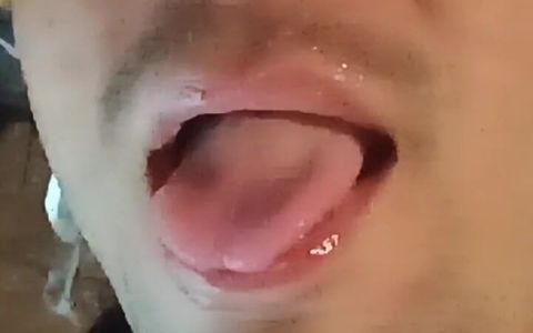 Tight Mouth Hole