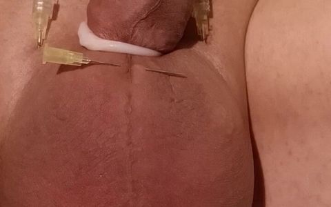 Needles in the penis and scrotum